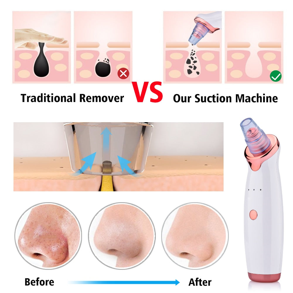 Blackhead Electric Suction Facial Washing Device