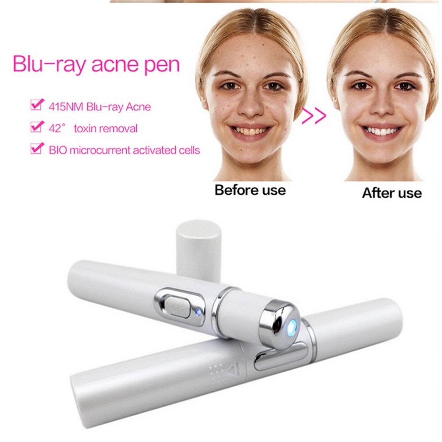 Blue Light Therapy Acne Laser Pen Soft Scar Wrinkle Removal Treatment Device