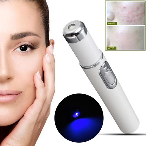 Blue Light Therapy Acne Laser Pen Soft Scar Wrinkle Removal Treatment Device