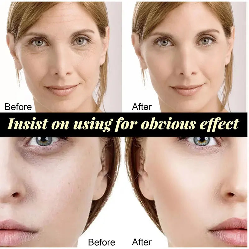 Face-Lifting Anti-Ageing Beauty Treatment Cosmetic