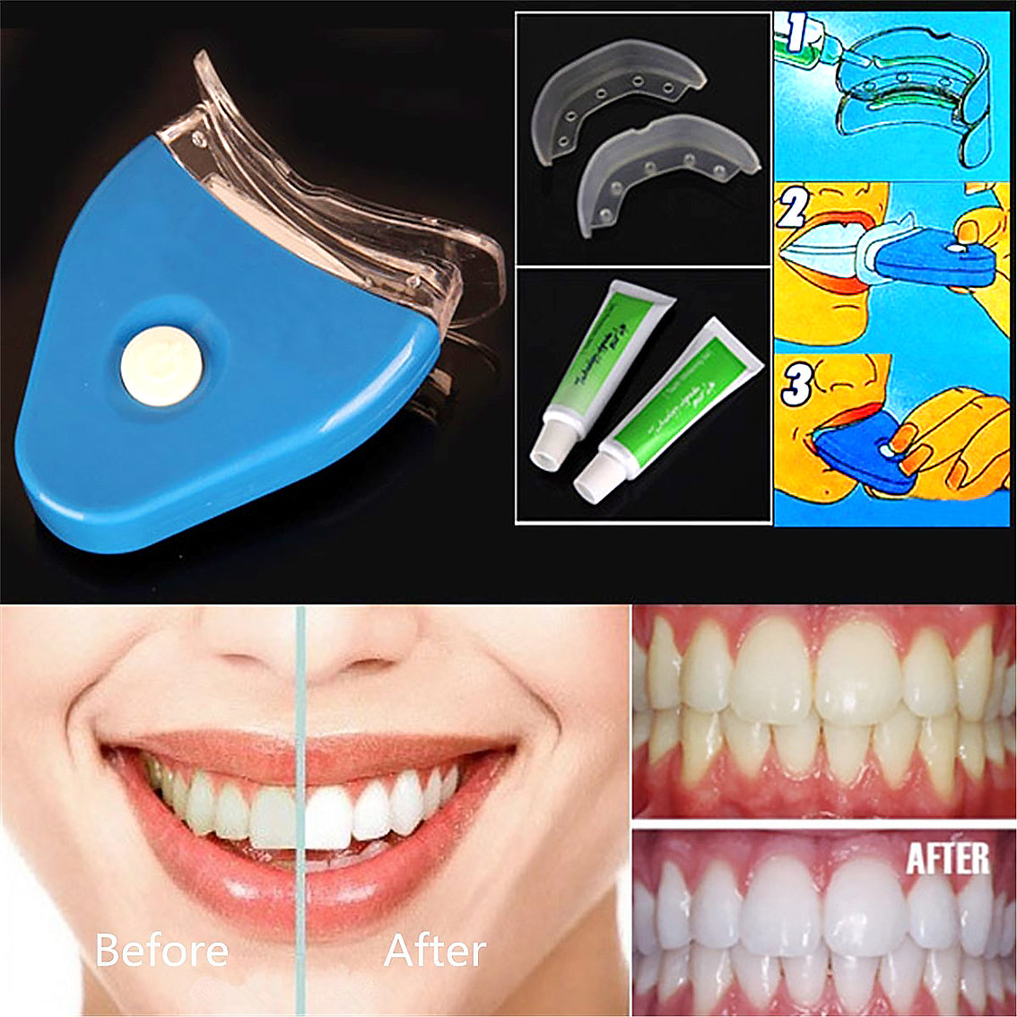 Oral Gel Teeth-Whitening Dental Bleaching LED